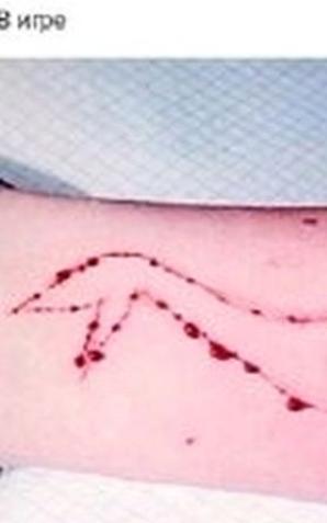 „Niebieski Wieloryb” – śmiertelna gra sieje postrach. Szkoły alarmują rodziców